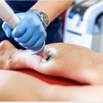 Softwave Therapy with Dr. Chekemian